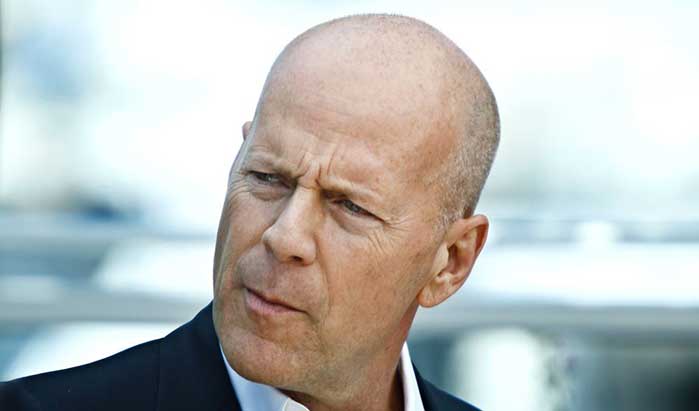 Bruce Willis e la sua calvizie