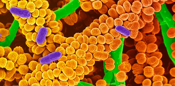 I batteri e le patologie infettive