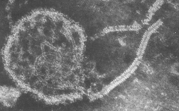 I virus: come sono, da cosa sono originati